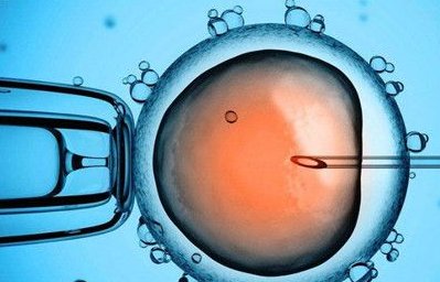 什么是人工授精影响人工授精成功率的因素